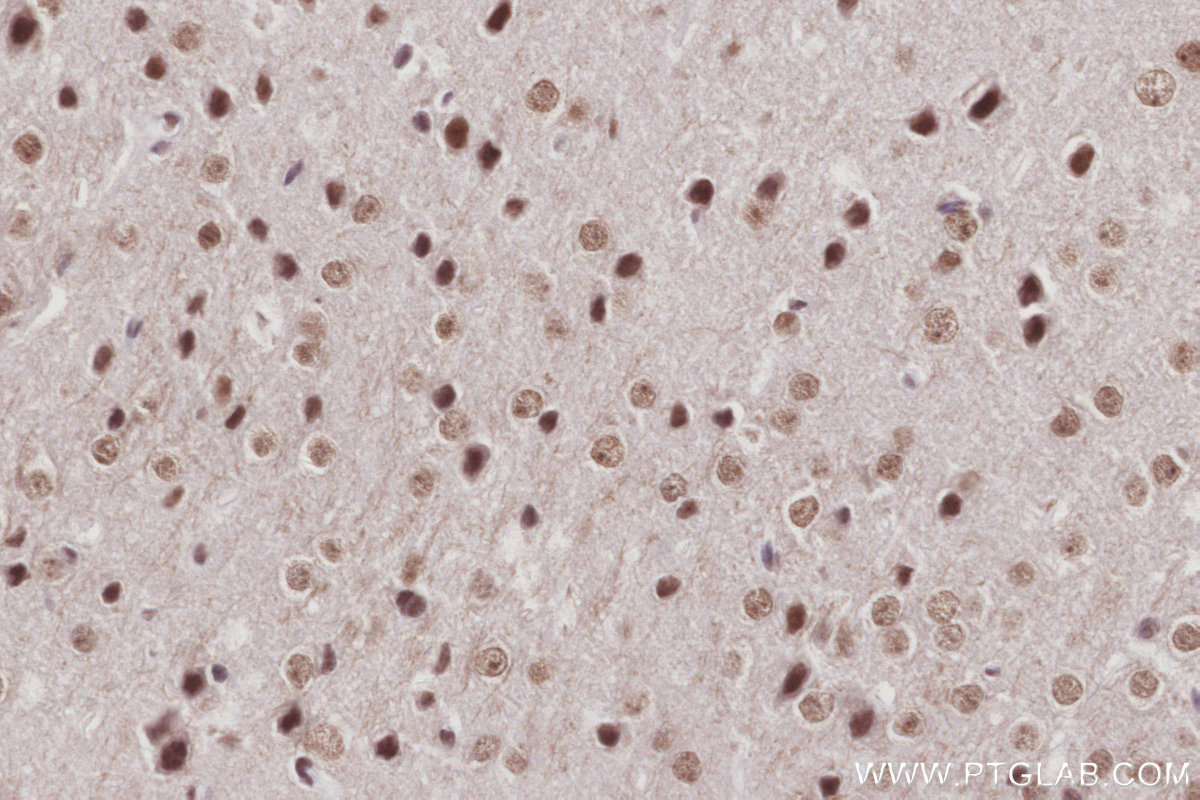 IHC staining of mouse brain using 26641-1-AP