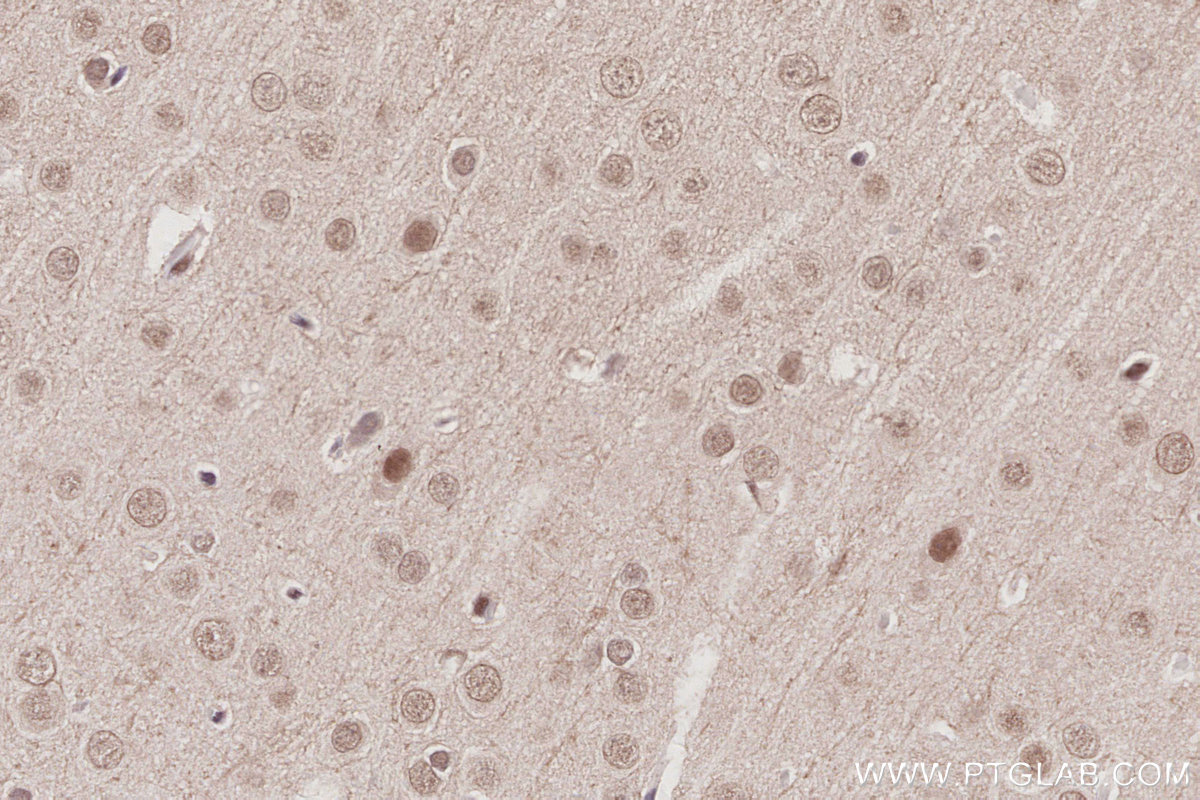 IHC staining of rat brain using 26641-1-AP