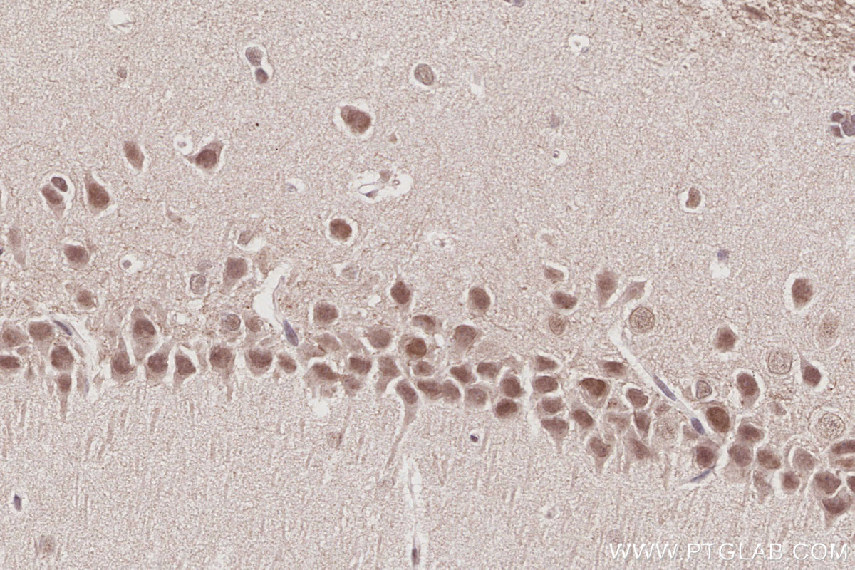 IHC staining of rat brain using 26641-1-AP