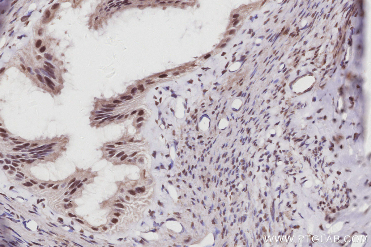 IHC staining of rat ovary using 26641-1-AP