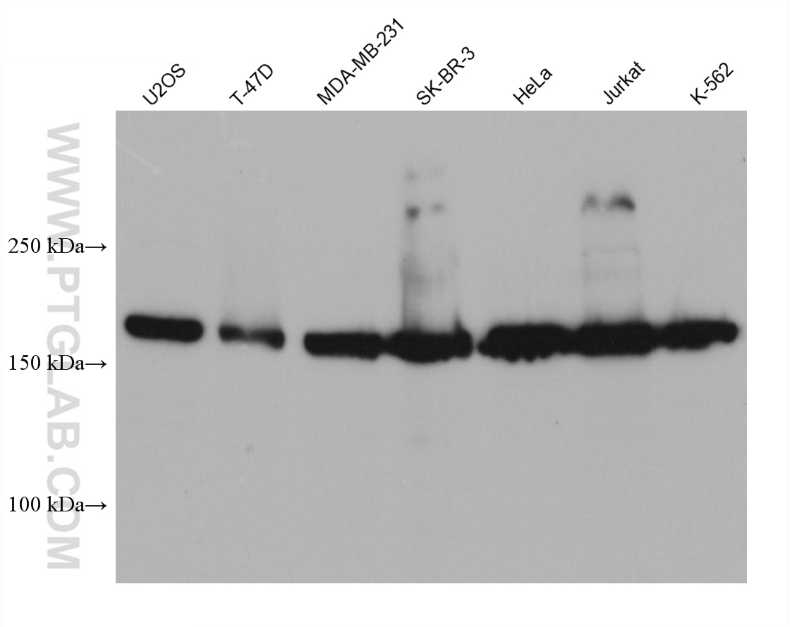 WB analysis using 68361-1-Ig