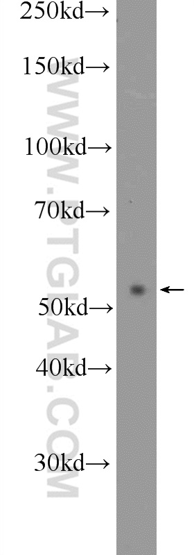 WB analysis of mouse kidney using 23235-1-AP