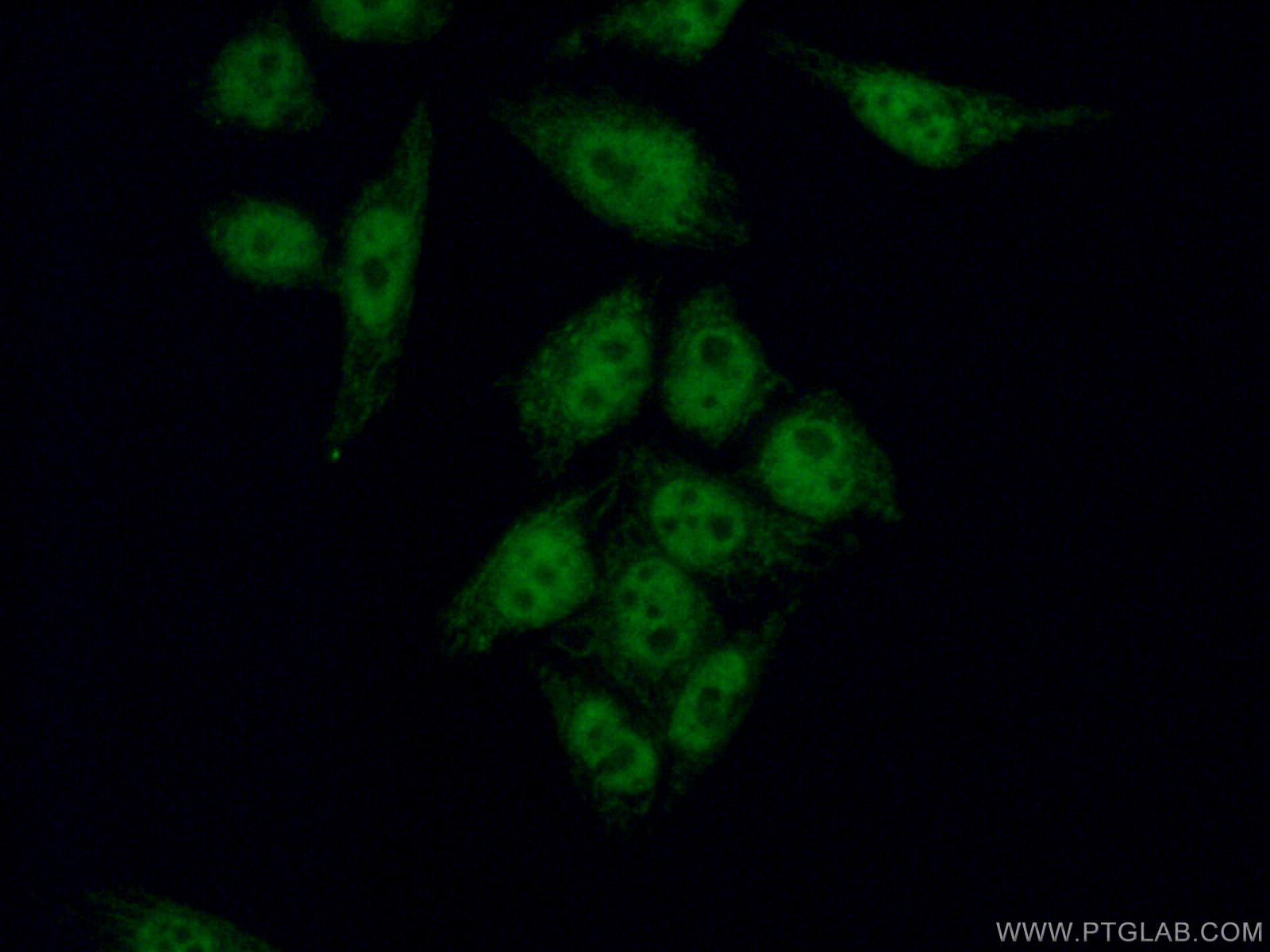 IF Staining of HeLa using 60188-1-Ig