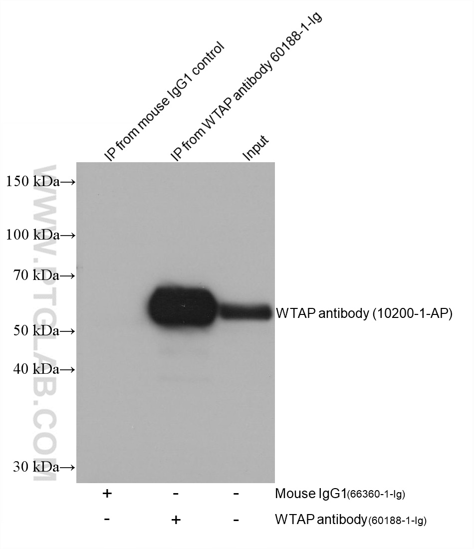 IP experiment of HeLa using 60188-1-Ig