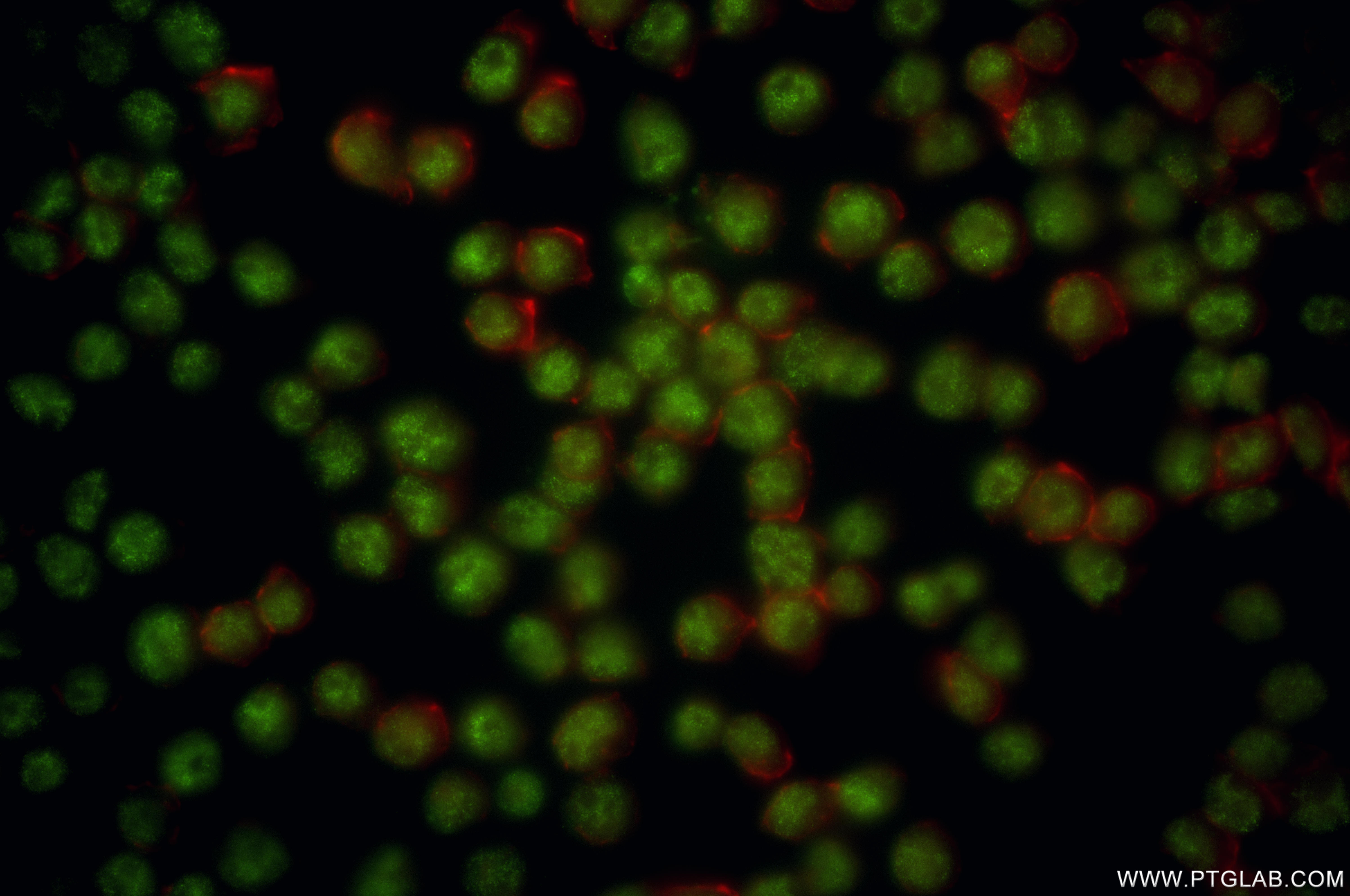 IF Staining of Jurkat using 81987-4-RR (same clone as 81987-4-PBS)