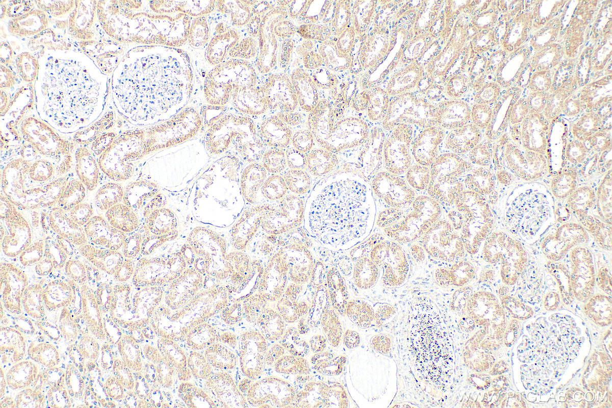 Immunohistochemical analysis of paraffin-embedded human kidney tissue slide using 24750-1-AP (WWC2 antibody) at dilution of 1:400 (under 10x lens). Heat mediated antigen retrieval with Tris-EDTA buffer (pH 9.0). IHC staining of human kidney using 24750-1-AP