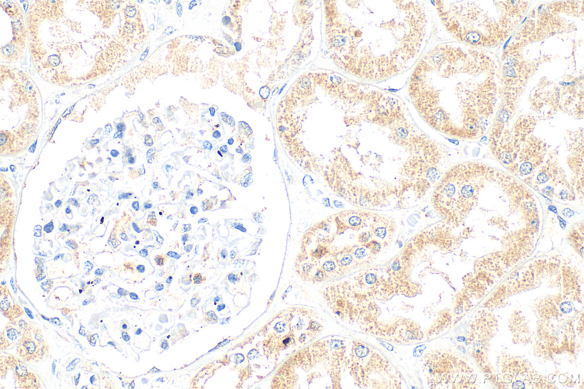 Immunohistochemical analysis of paraffin-embedded human kidney tissue slide using 24750-1-AP (WWC2 antibody) at dilution of 1:400 (under 40x lens). Heat mediated antigen retrieval with Tris-EDTA buffer (pH 9.0). IHC staining of human kidney using 24750-1-AP