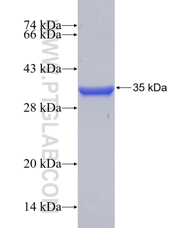 WWC2 fusion protein Ag20473 SDS-PAGE