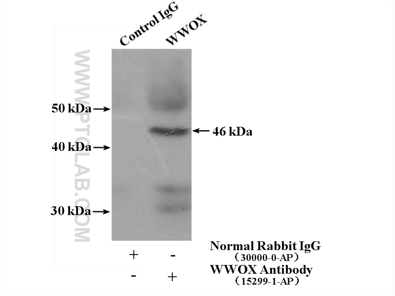 IP experiment of mouse skeletal muscle using 15299-1-AP