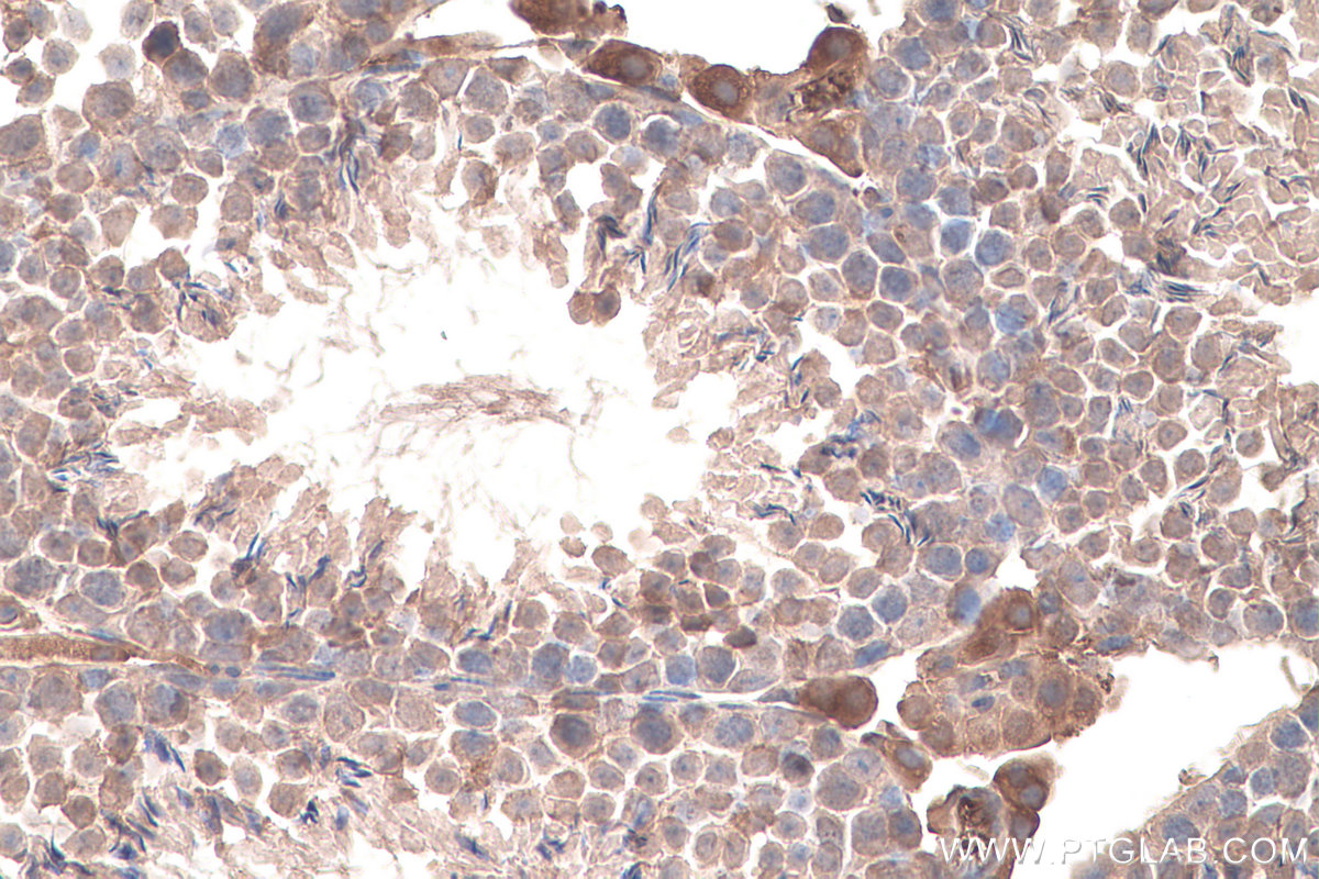 IHC staining of mouse testis using 67725-1-Ig