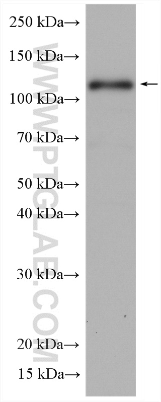 WB analysis of HepG2 using 28689-1-AP (same clone as 28689-1-PBS)