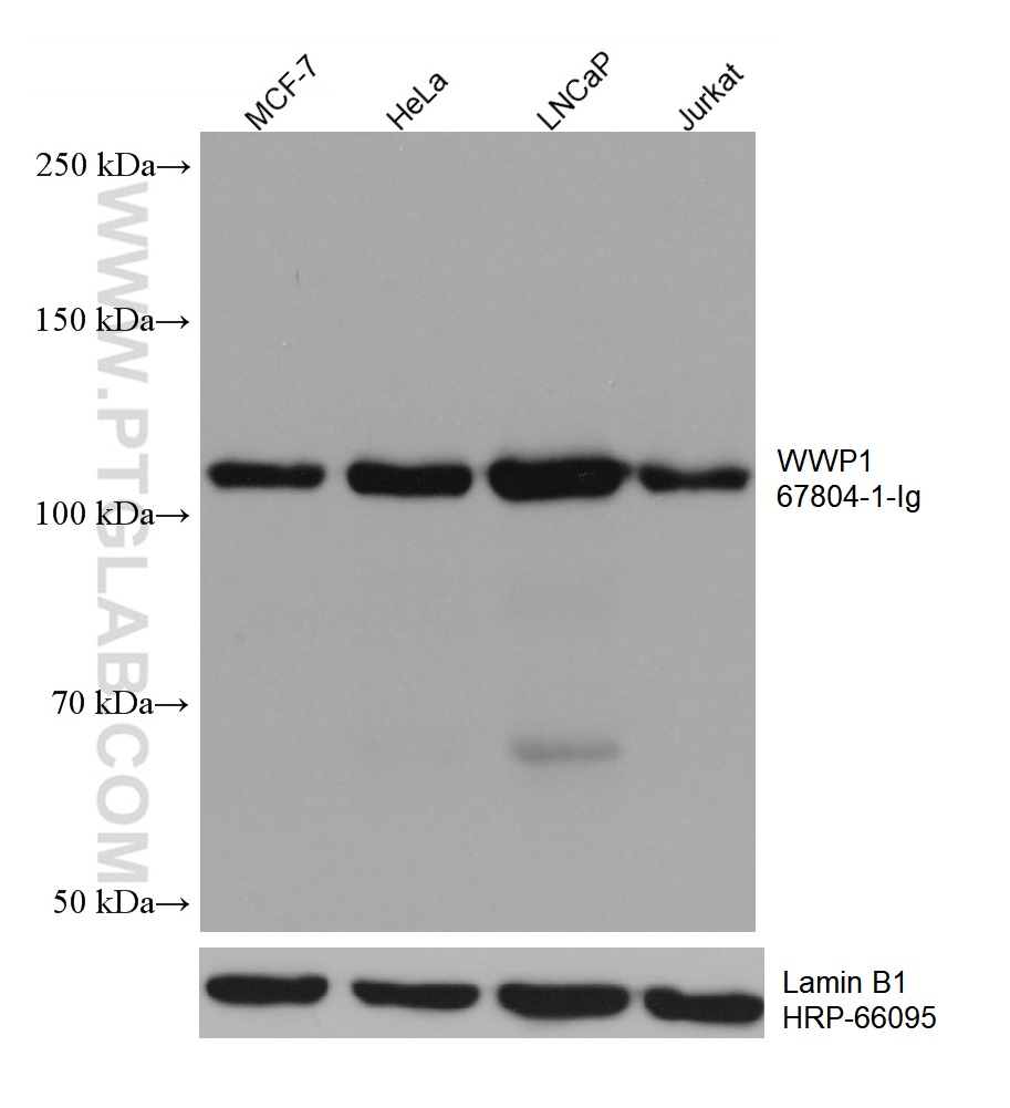 WB analysis using 67804-1-Ig (same clone as 67804-1-PBS)