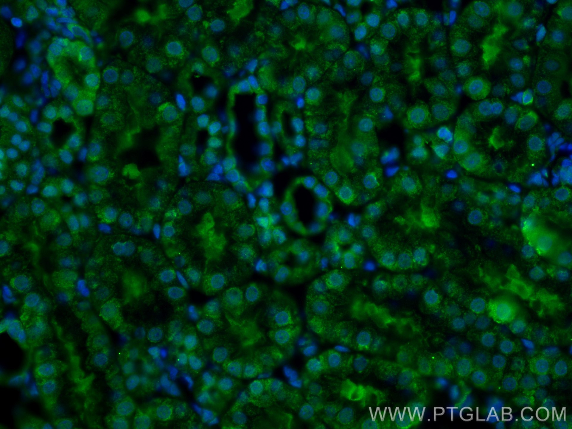 IF Staining of rat kidney using 23306-1-AP