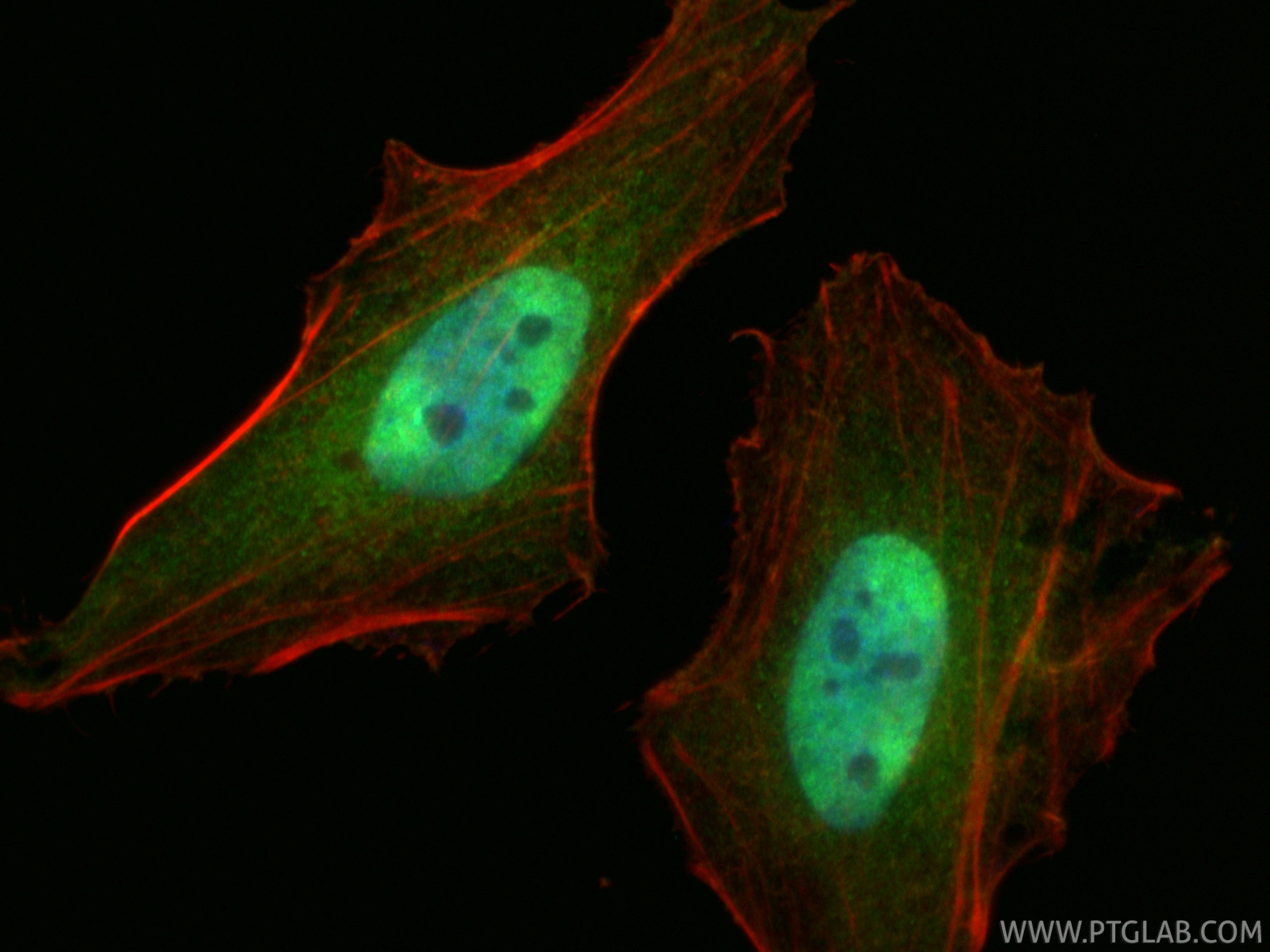 IF Staining of HeLa using 23306-1-AP