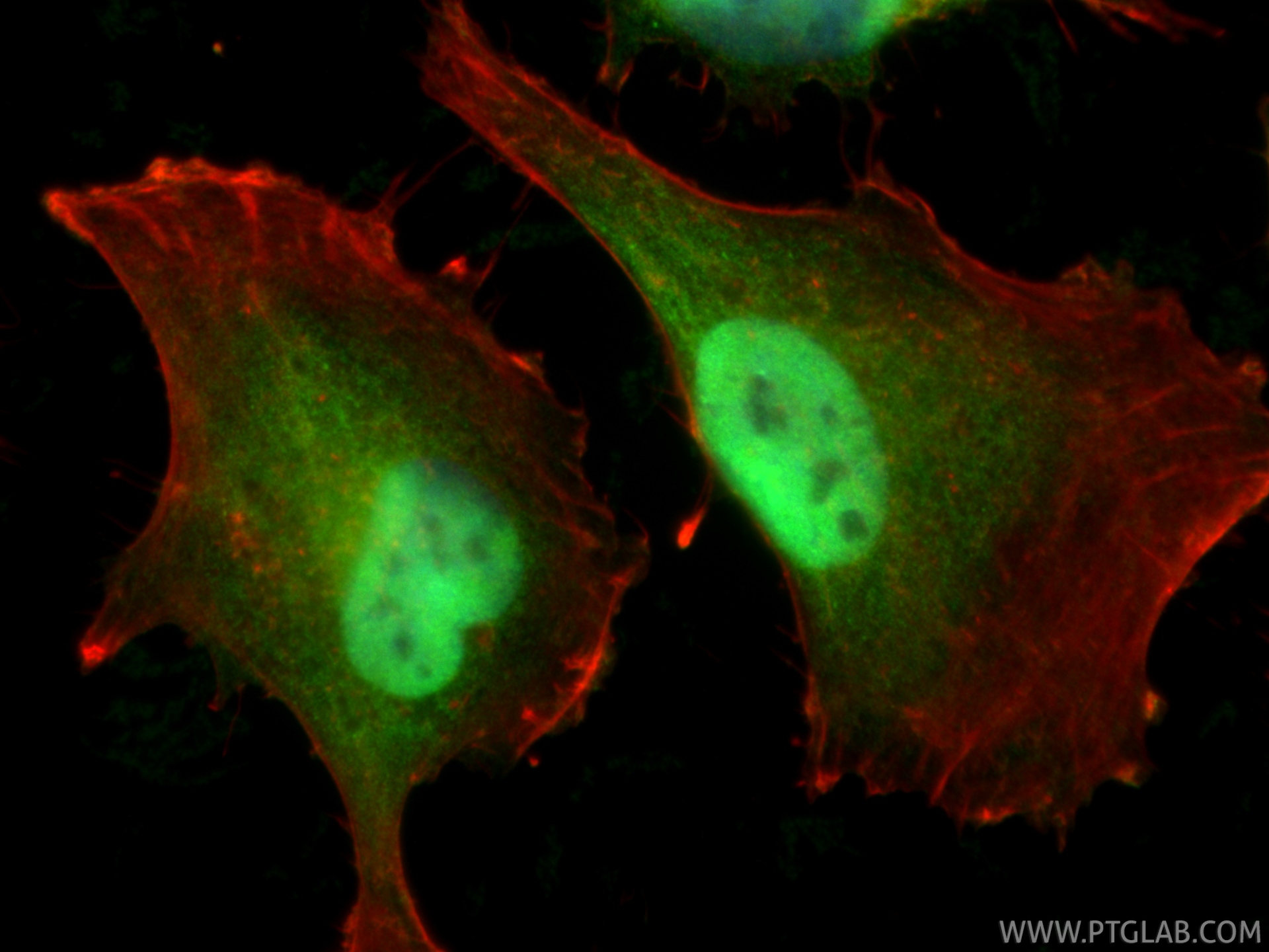 IF Staining of U-251 using 23306-1-AP