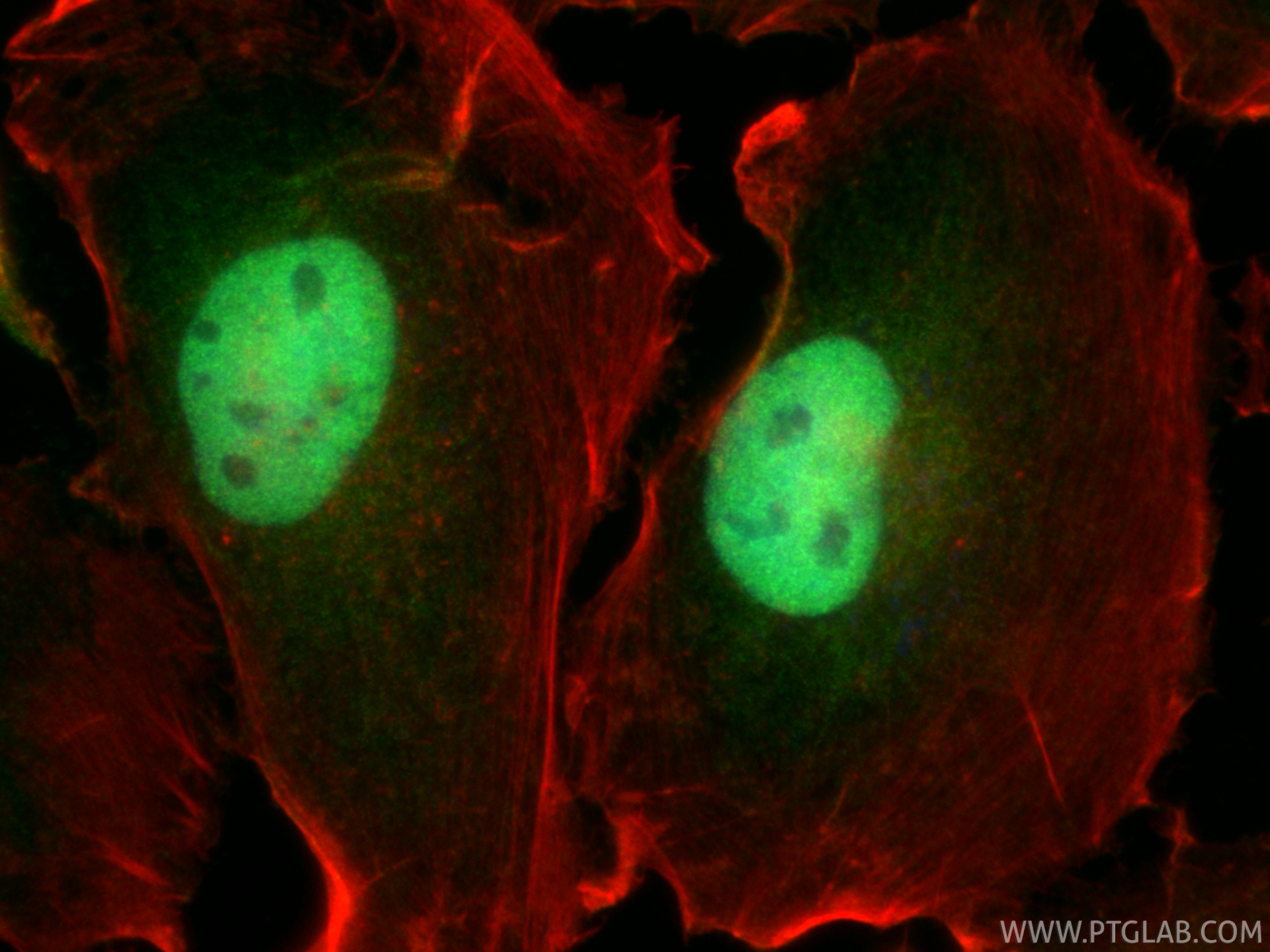 IF Staining of U-251 using 23306-1-AP