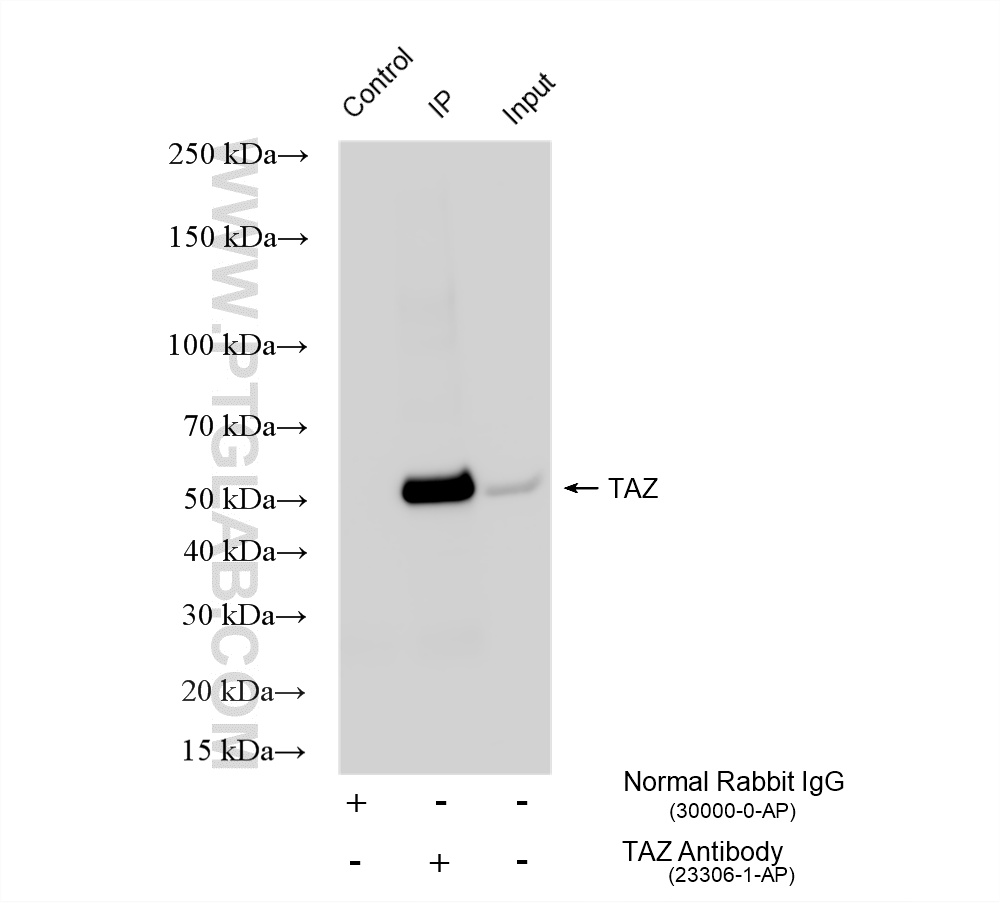 IP experiment of MDA-MB-453 using 23306-1-AP