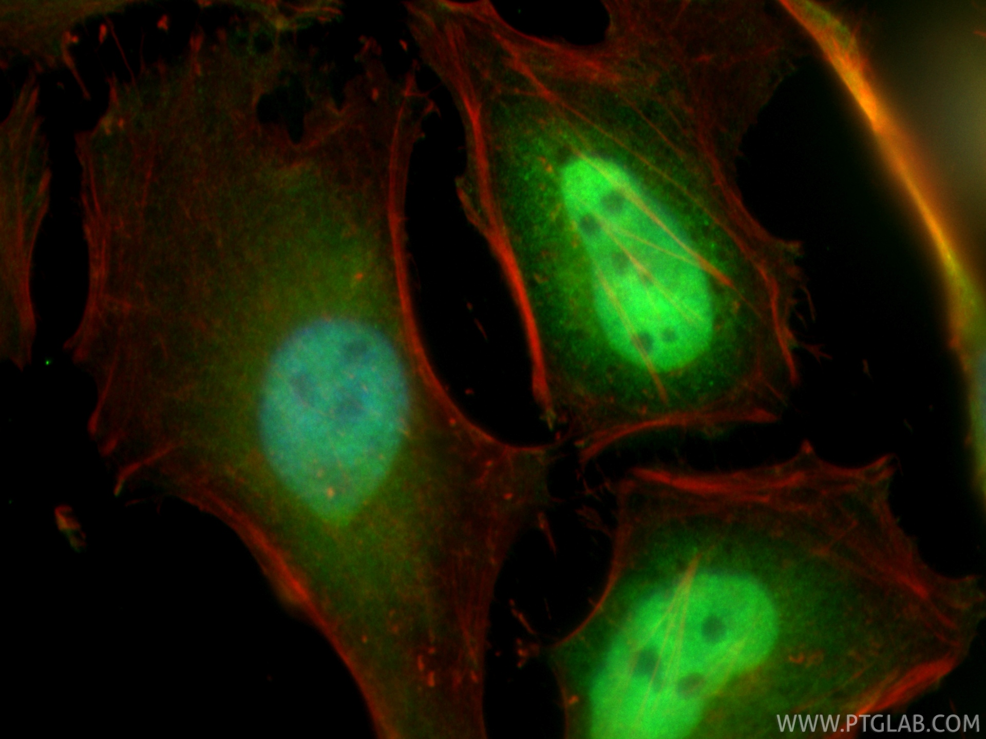 IF Staining of HeLa using CL488-23306