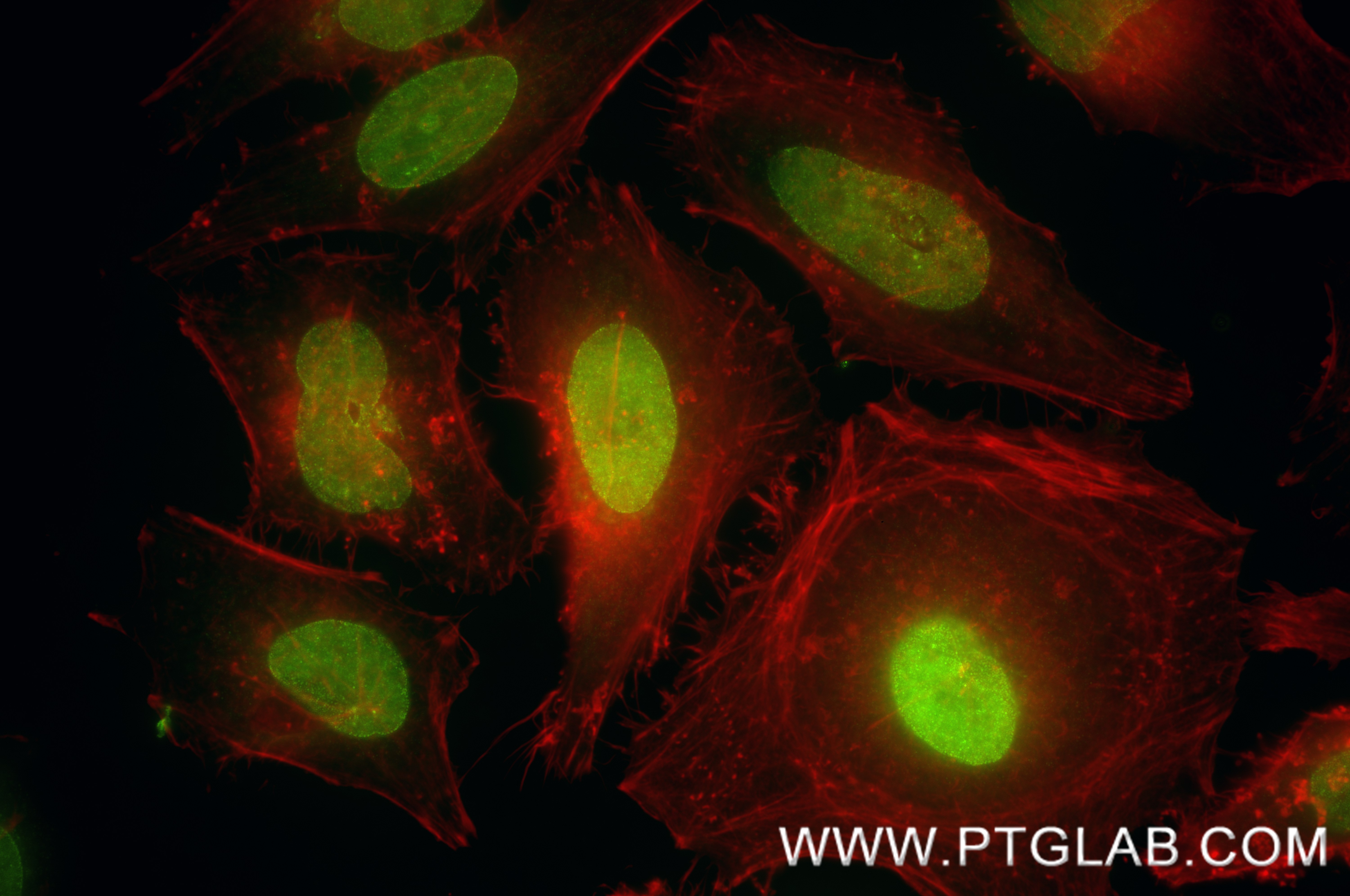 IF Staining of HeLa using 85245-5-RR IF Staining of HeLa using 85245-5-RR