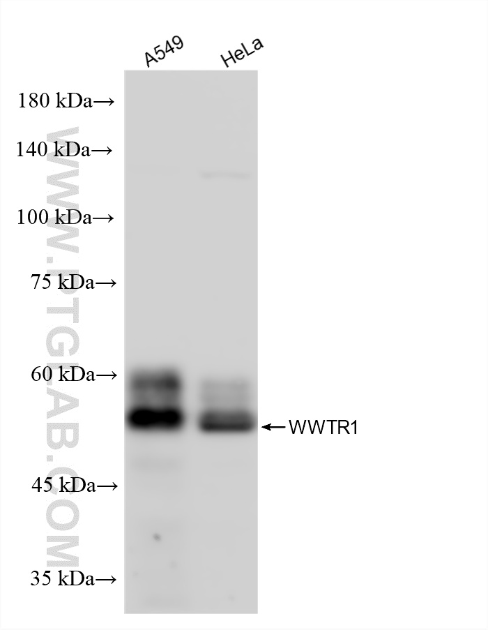 WB analysis using 85245-5-RR WB analysis using 85245-5-RR