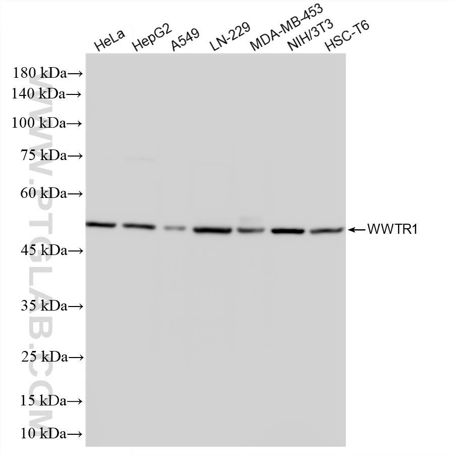 WB analysis using 85245-6-RR WB analysis using 85245-6-RR