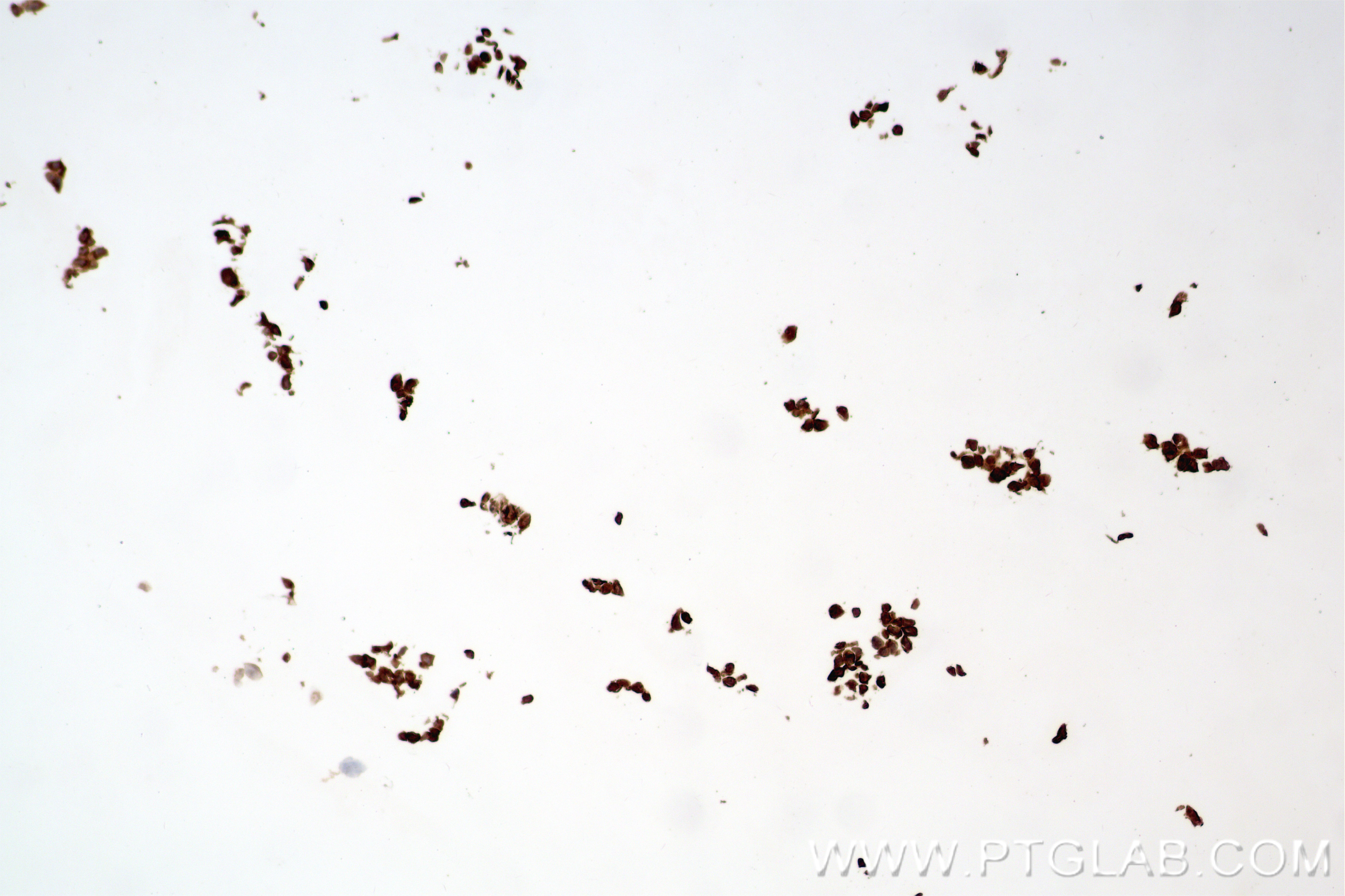 Immunohistochemical analysis of paraffin-embedded transfected HEK-293T cells slide using 98672-3-RR (Whitlow/218 Linker antibody) at dilution of 1:1000 (under 10x lens). Heat mediated antigen retrieval with Tris-EDTA buffer (pH 9.0). IHC staining of 293T cell(218Linker) using 98672-3-RR