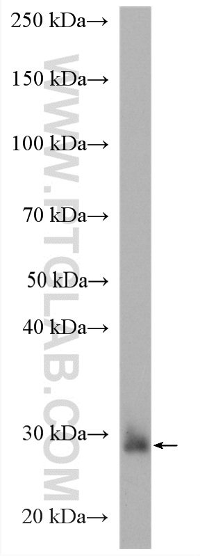 WB analysis of U-251 using 21039-1-AP