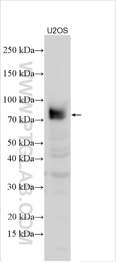 Various lysates were subjected to SDS PAGE followed by western blot with 21039-1-AP (Willin antibody) at dilution of 1:400 incubated at room temperature for 1.5 hours. WB analysis using 21039-1-AP