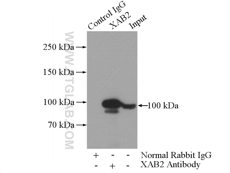 IP experiment of K-562 using 10637-1-AP