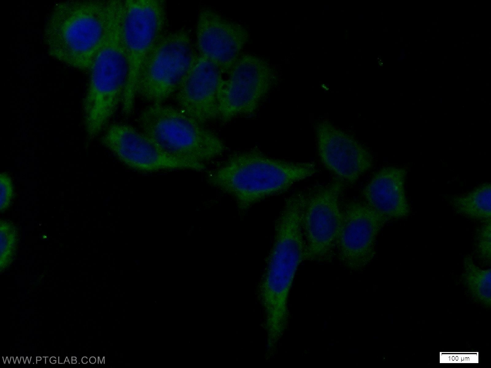 IF Staining of HeLa using 17837-1-AP