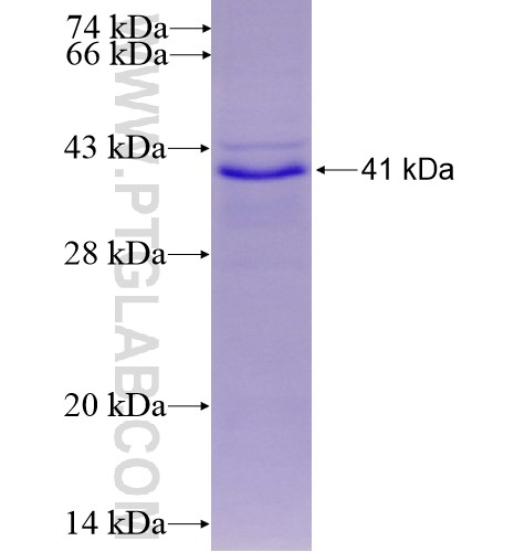 XAF1 fusion protein Ag12083 SDS-PAGE XAF1 fusion protein Ag12083 SDS-PAGE