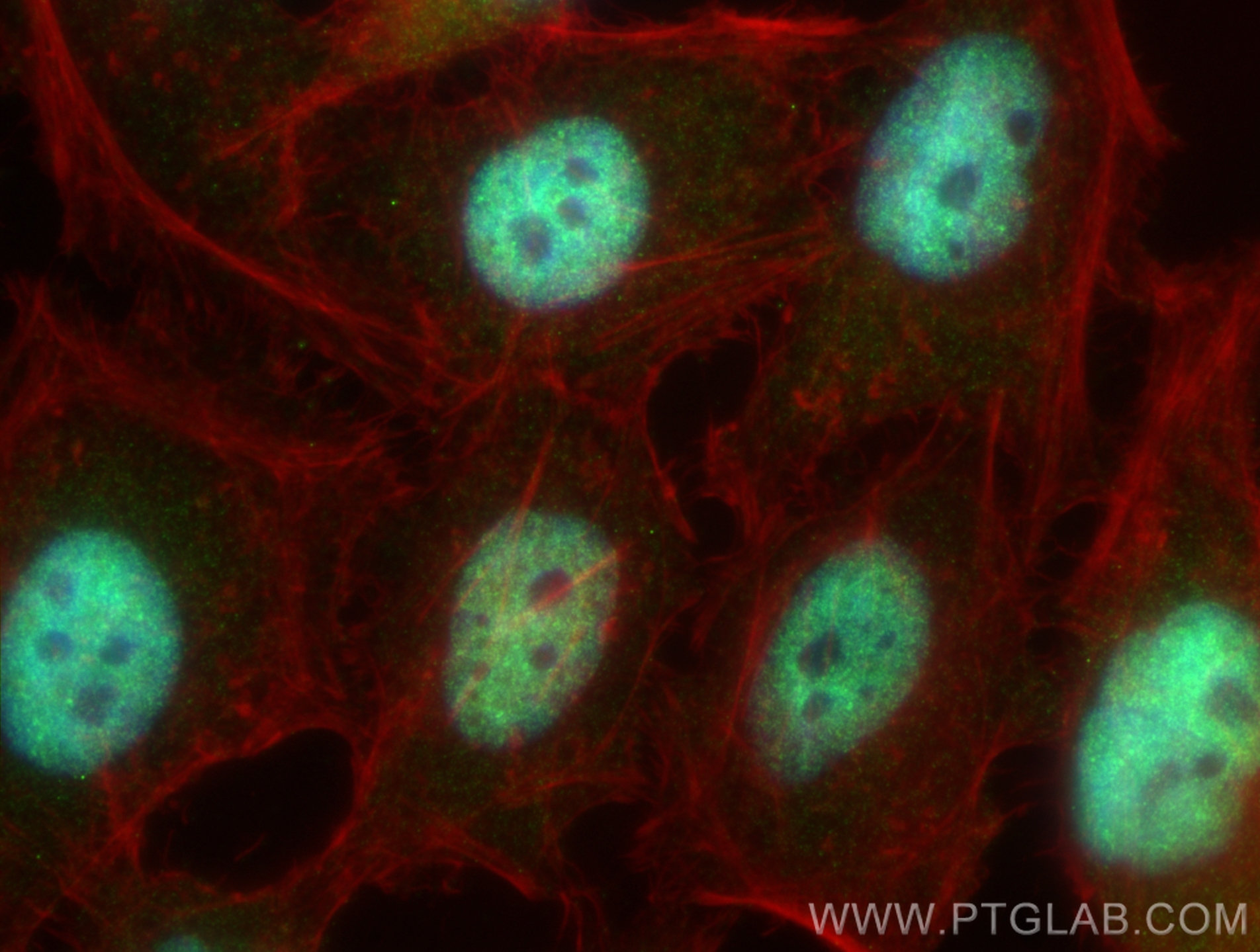 IF Staining of HeLa using 33118-1-AP
