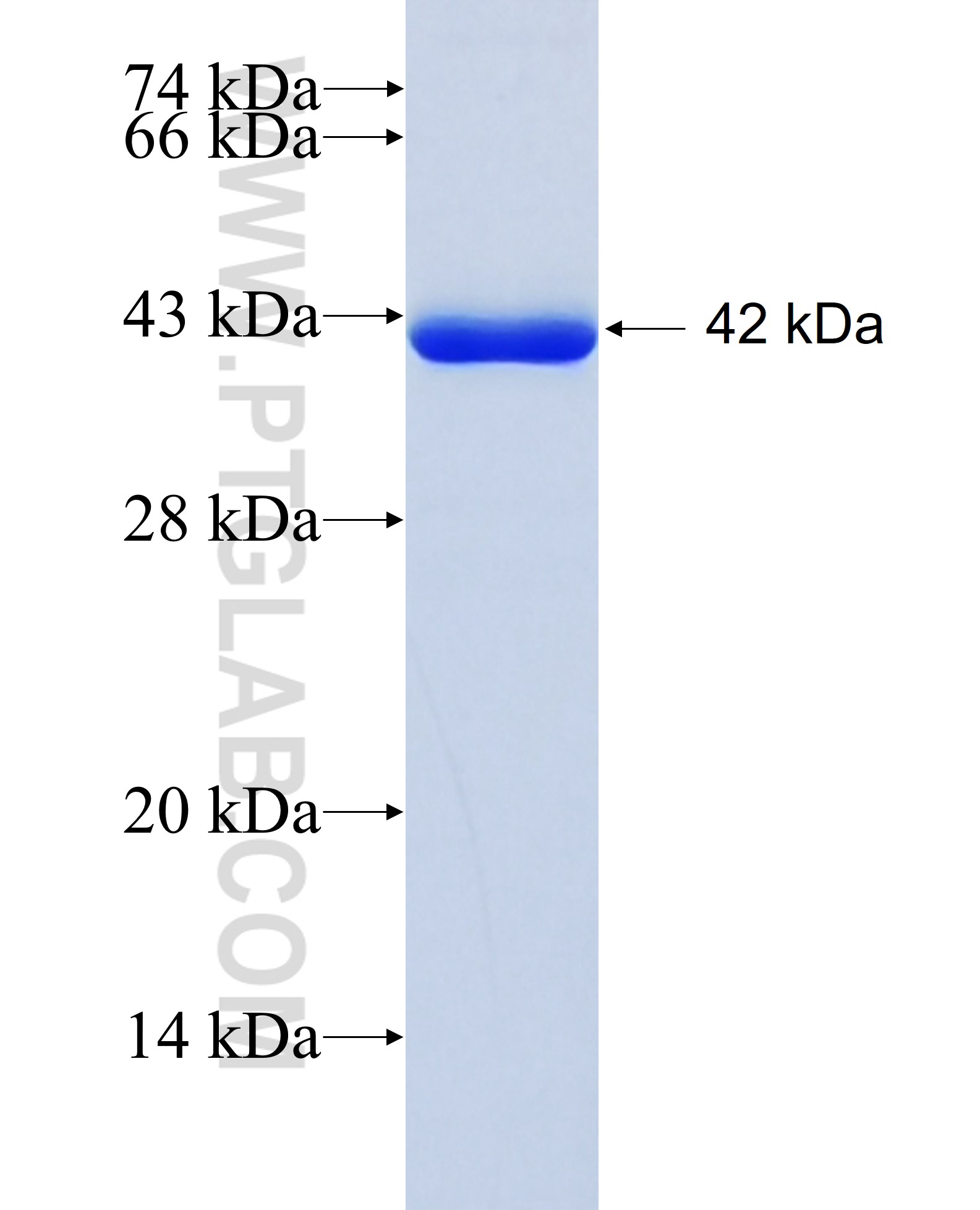 XAGE2 fusion protein Ag35814 SDS-PAGE