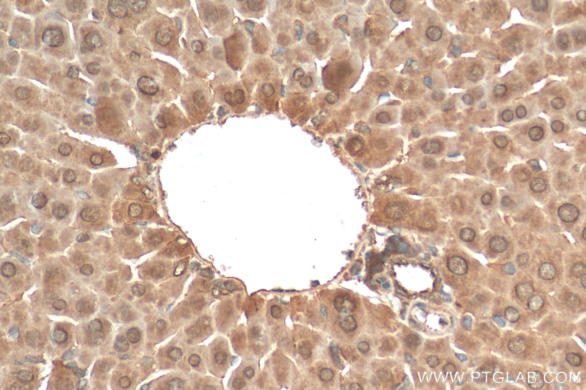 IHC staining of mouse liver using 24168-1-AP