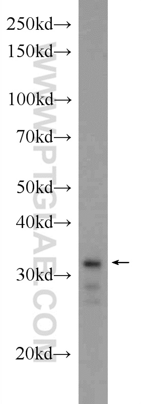 XBP1S/XBP1U Polyclonal antibody
