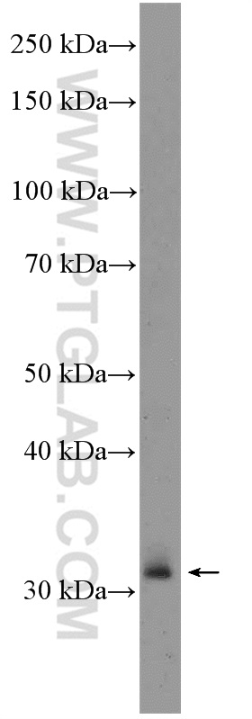 WB analysis of rat spleen using 25997-1-AP