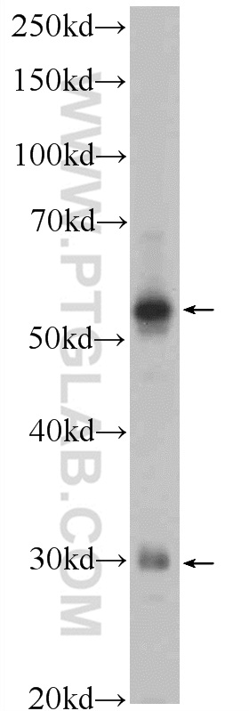 XBP1S-specific Polyclonal antibody