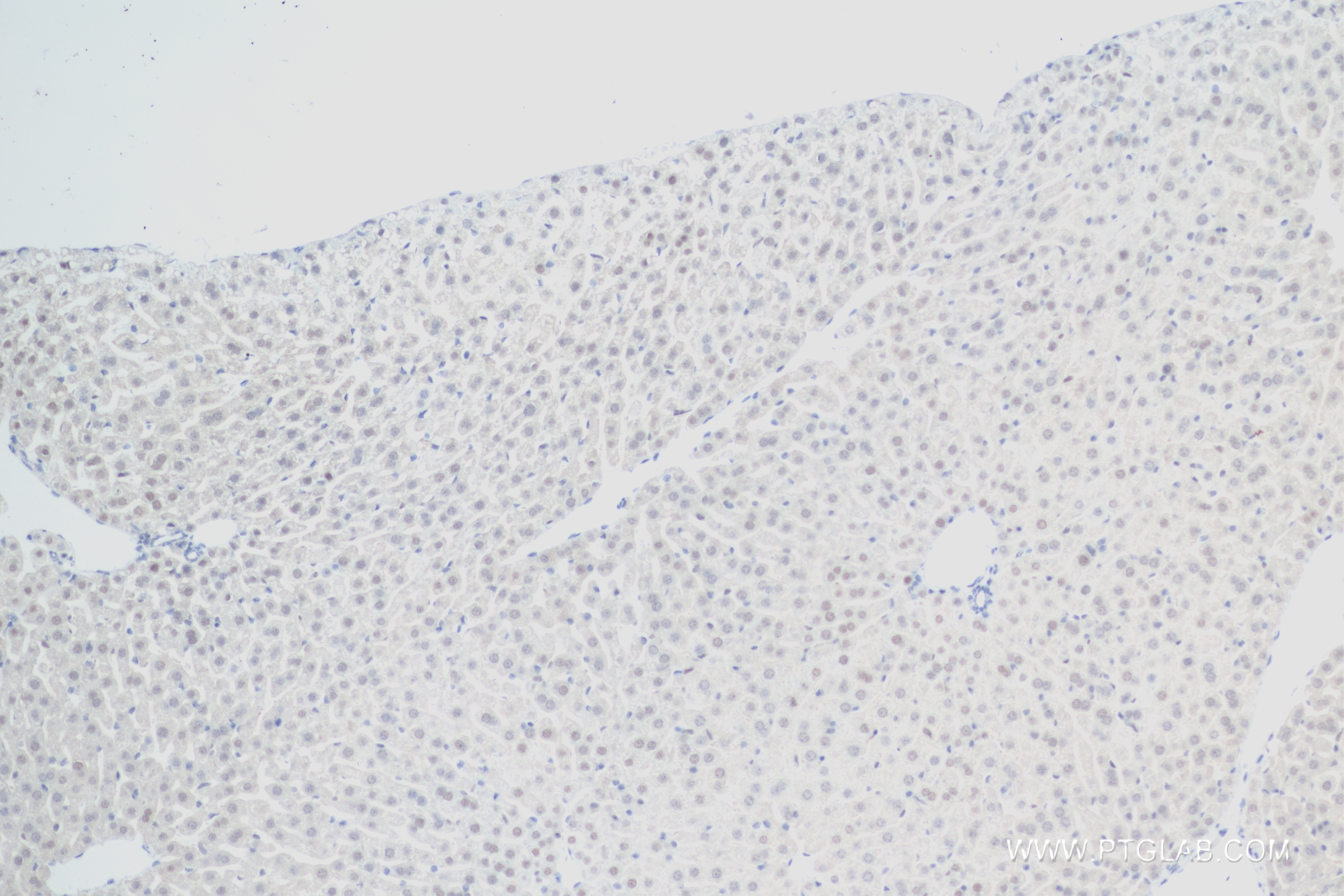 IHC staining of mouse liver using 83959-6-RR (same clone as 83959-6-PBS)