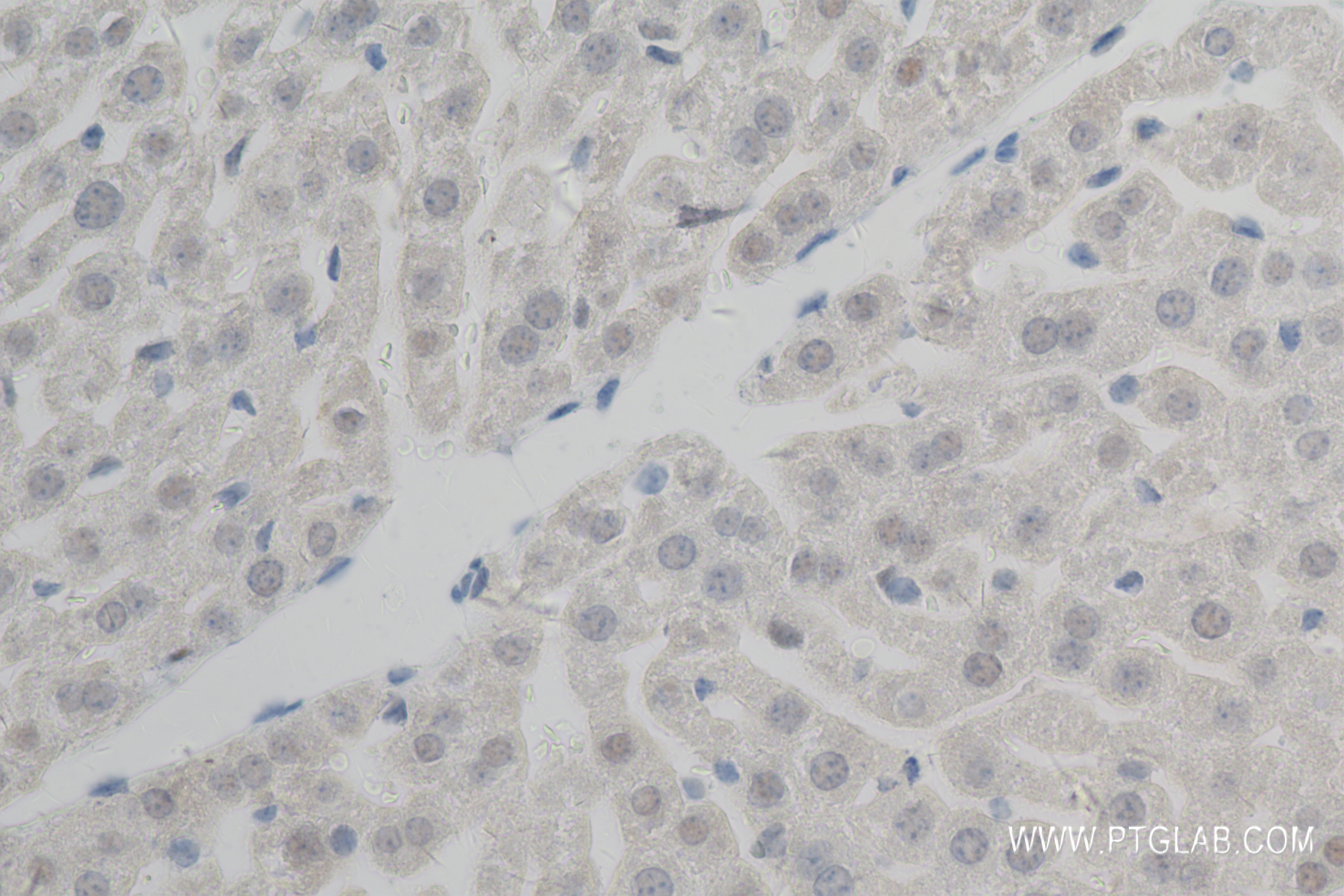 IHC staining of mouse liver using 83959-6-RR (same clone as 83959-6-PBS)