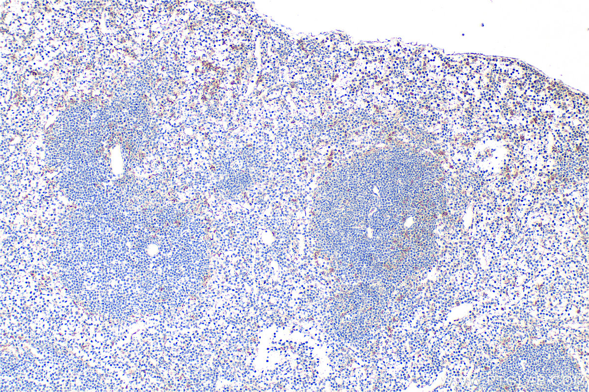 IHC staining of mouse spleen using 33408-1-AP