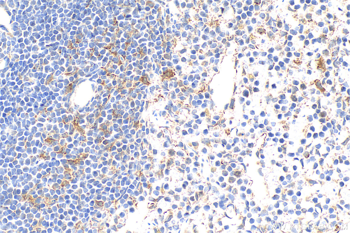 IHC staining of mouse spleen using 33408-1-AP