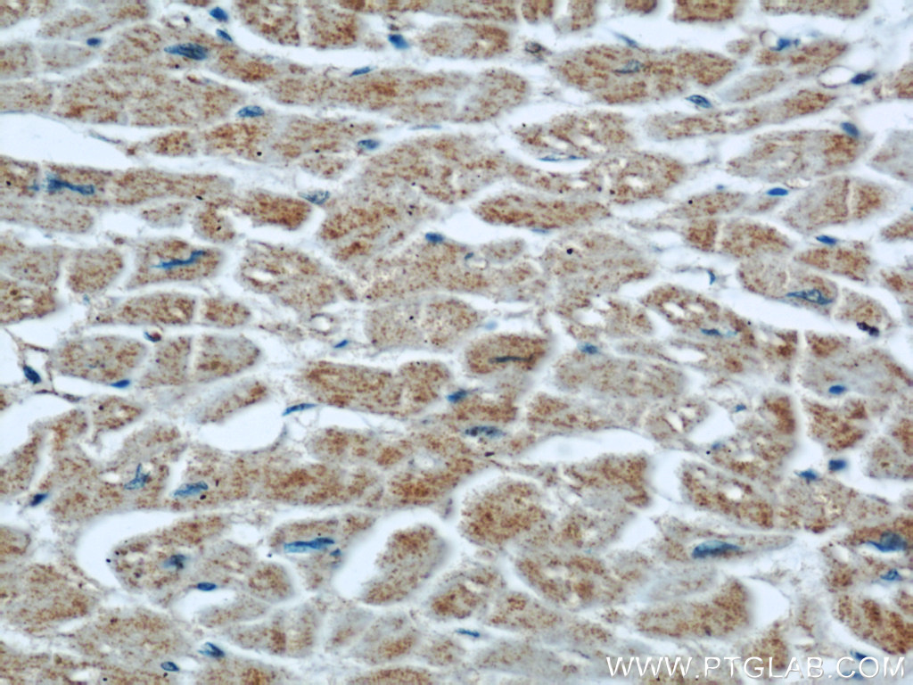 IHC staining of human heart using 55156-1-AP