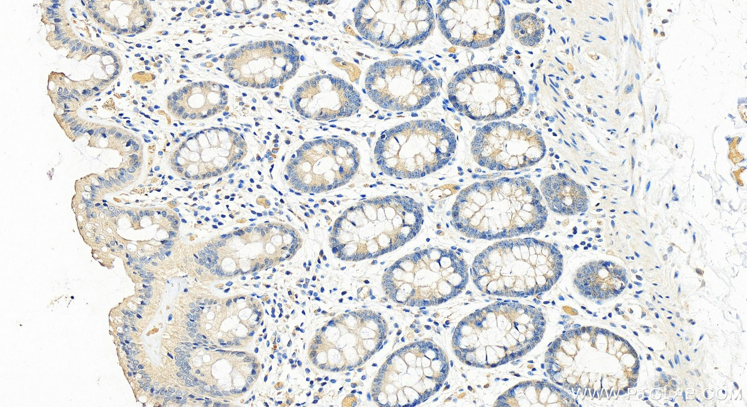 IHC staining of human colon using 23453-1-AP