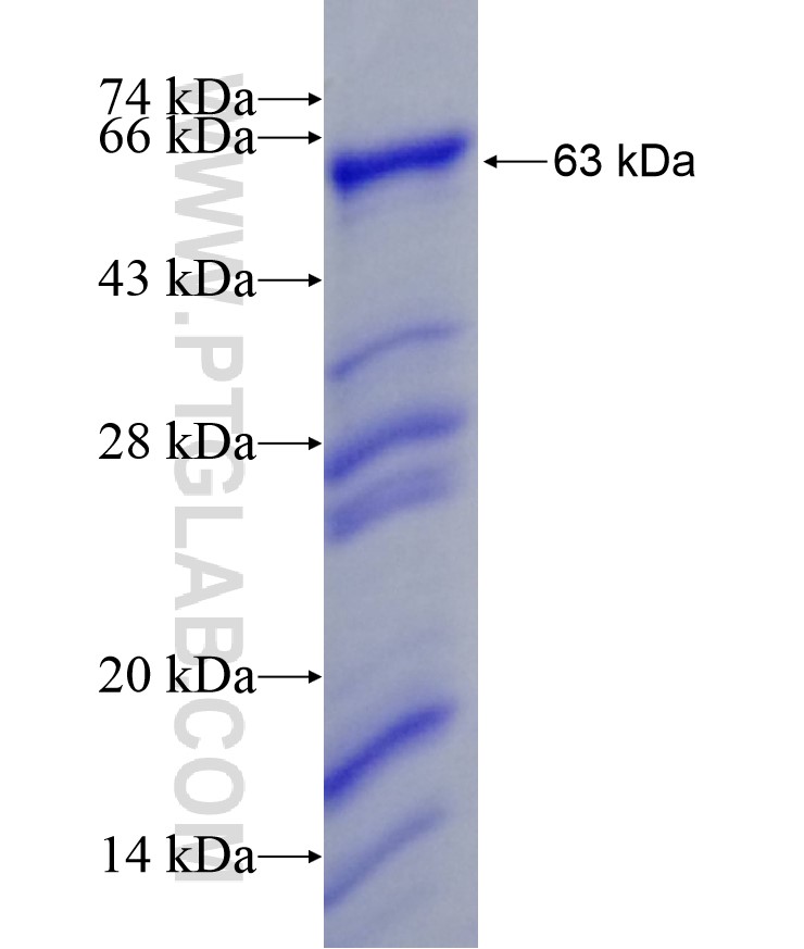 XIAP fusion protein Ag18088 SDS-PAGE