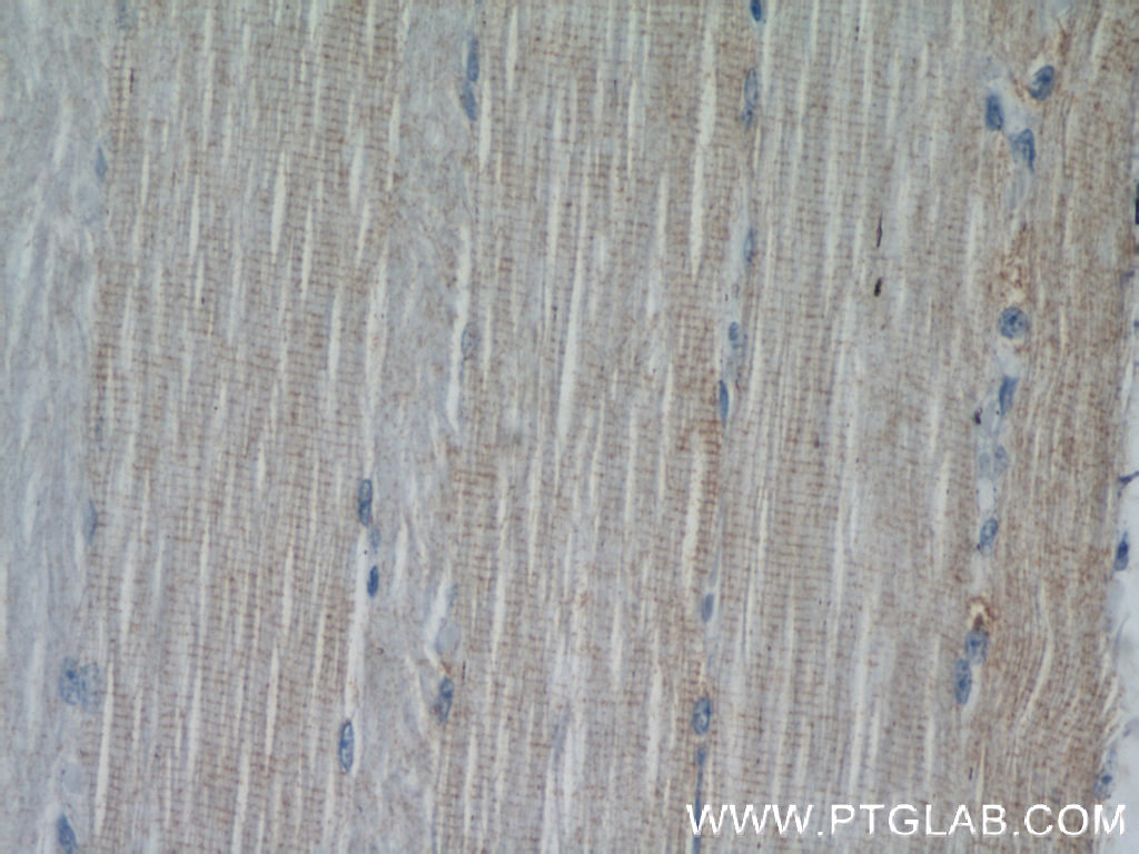 IHC staining of human skeletal muscle using 11896-1-AP