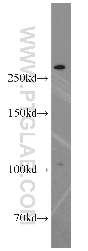 WB analysis of COLO 320 using 11896-1-AP