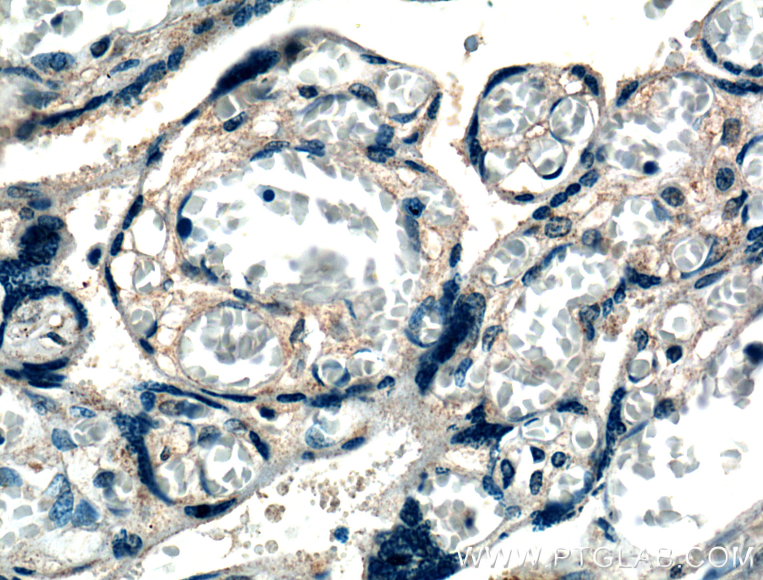 IHC staining of human placenta using 27049-1-AP