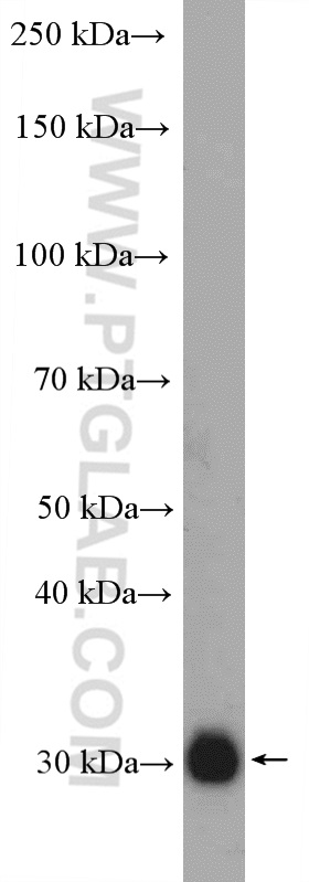 WB analysis of human placenta using 27049-1-AP