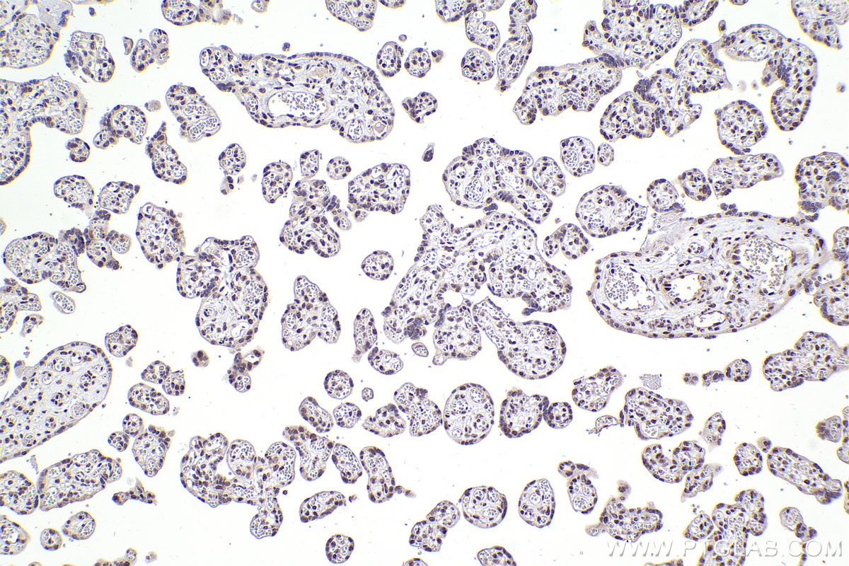 IHC staining of human placenta using 16462-1-AP IHC staining of human placenta using 16462-1-AP