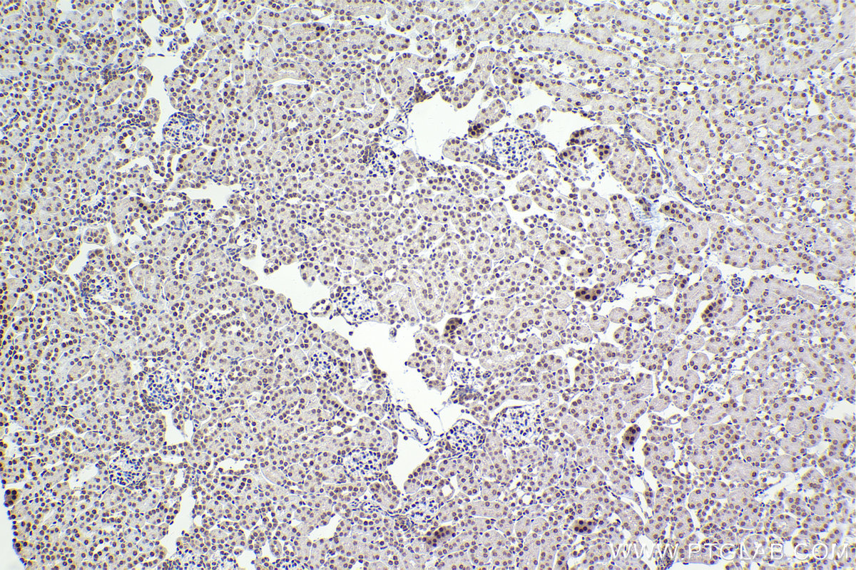 IHC staining of mouse kidney using 16462-1-AP IHC staining of mouse kidney using 16462-1-AP